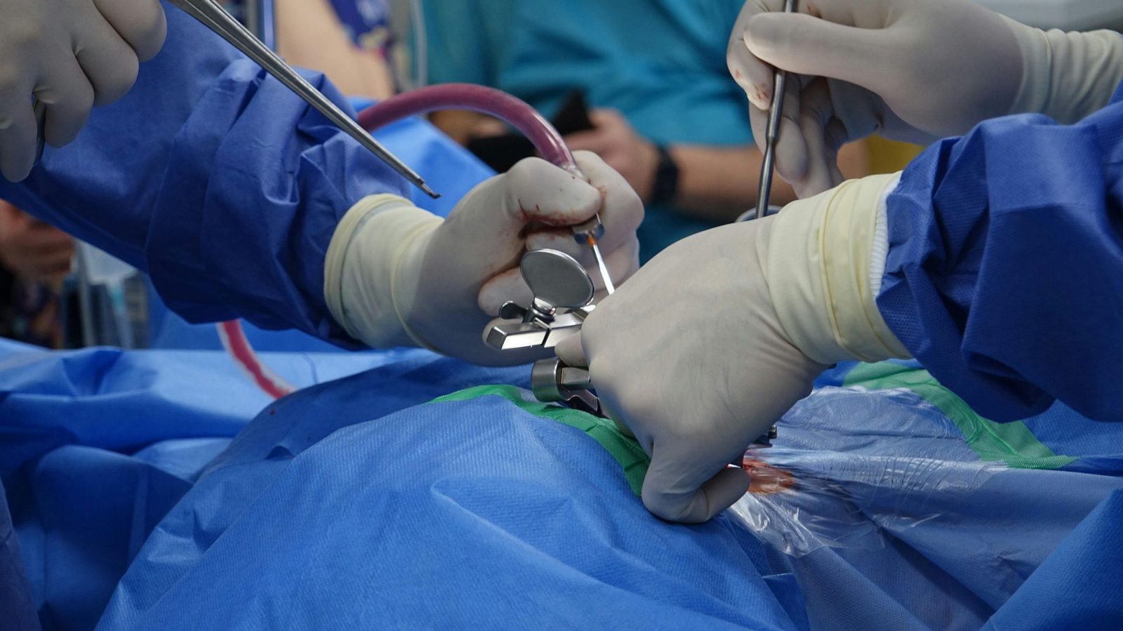 CARDIOLOGY Treatment and Rehabilitation: A Clear Roadmap for Recovery After Stent Procedures