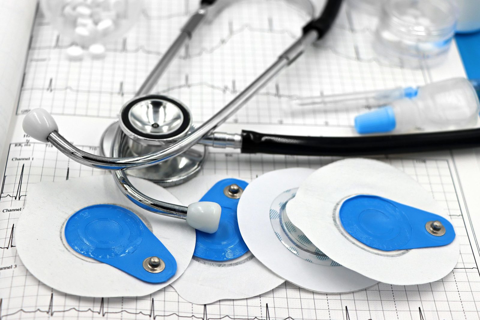 CARDIOLOGY Diagnosis and Tests: How Doctors Detect Artery Blockages Before Stent Procedures