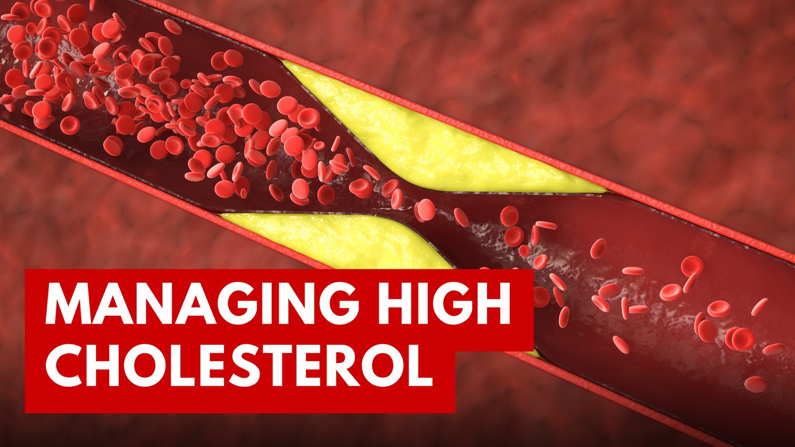 High Cholesterol Diet: Heart-Healthy Foods & Meal Plan Guide