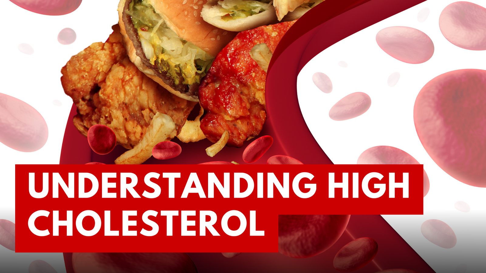 High Cholesterol: Causes, Symptoms & Effective Treatments Explained