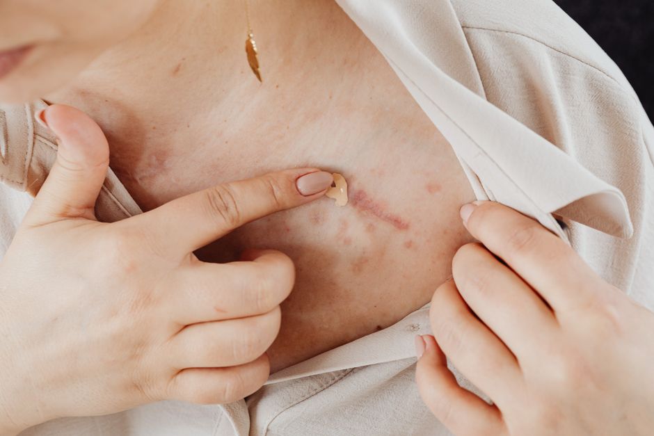 Bec Zacharia confirms rib repositioning surgery in Bali as part of group of ten influencers